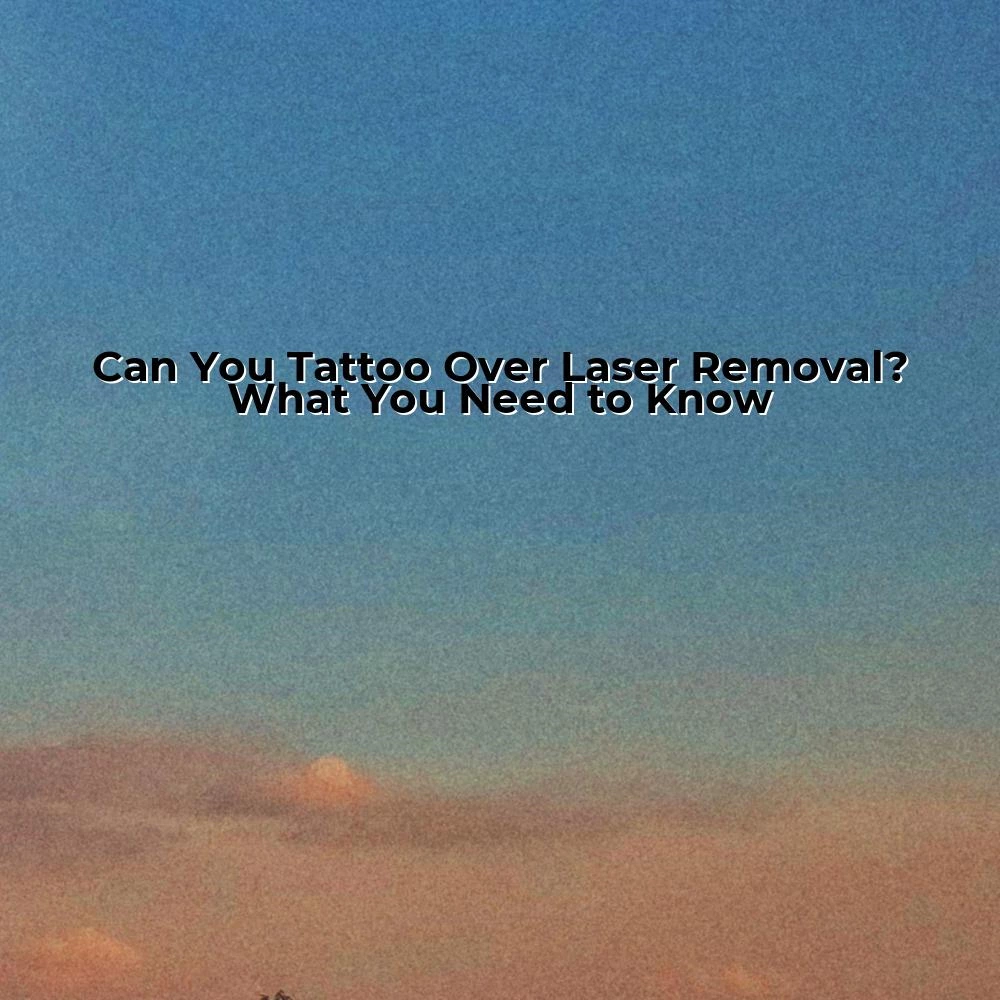 Can You Tattoo Over Laser Removal? What You Need to Know