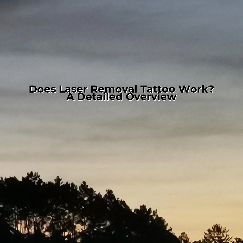 Does Laser Removal Tattoo Work? A Detailed Overview