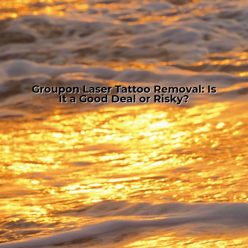 Groupon Laser Tattoo Removal