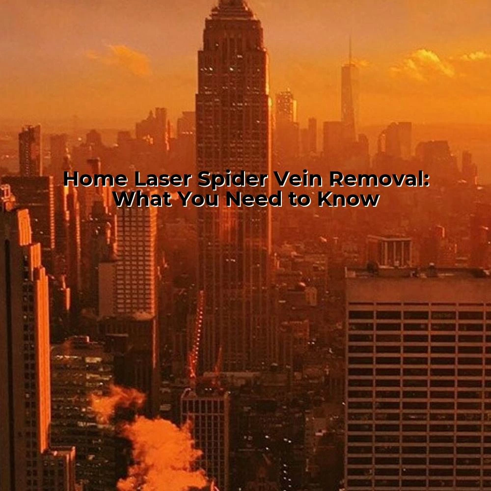 Home Laser Spider Vein Removal