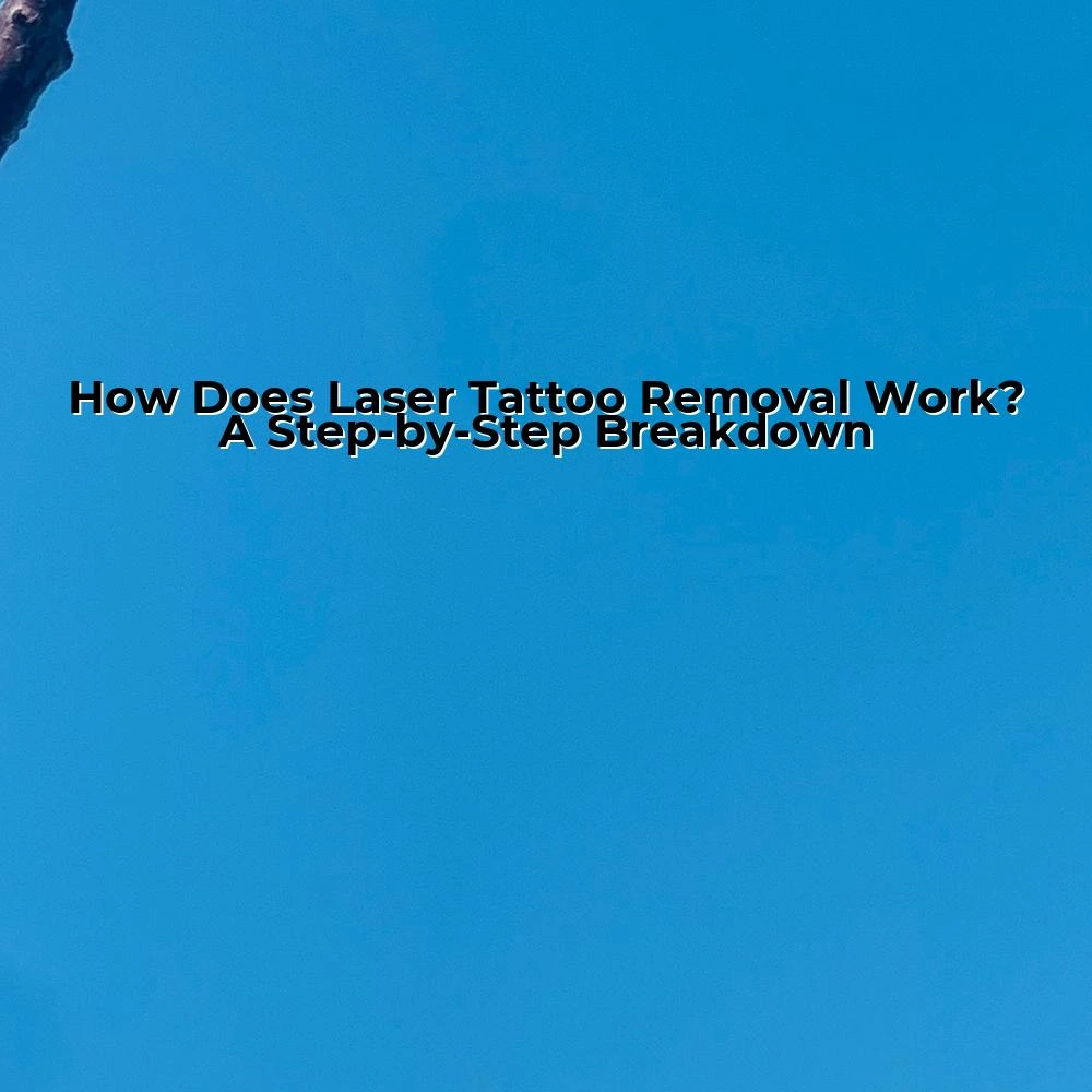 How Does Laser Tattoo Removal Work? A Step-by-Step Breakdown