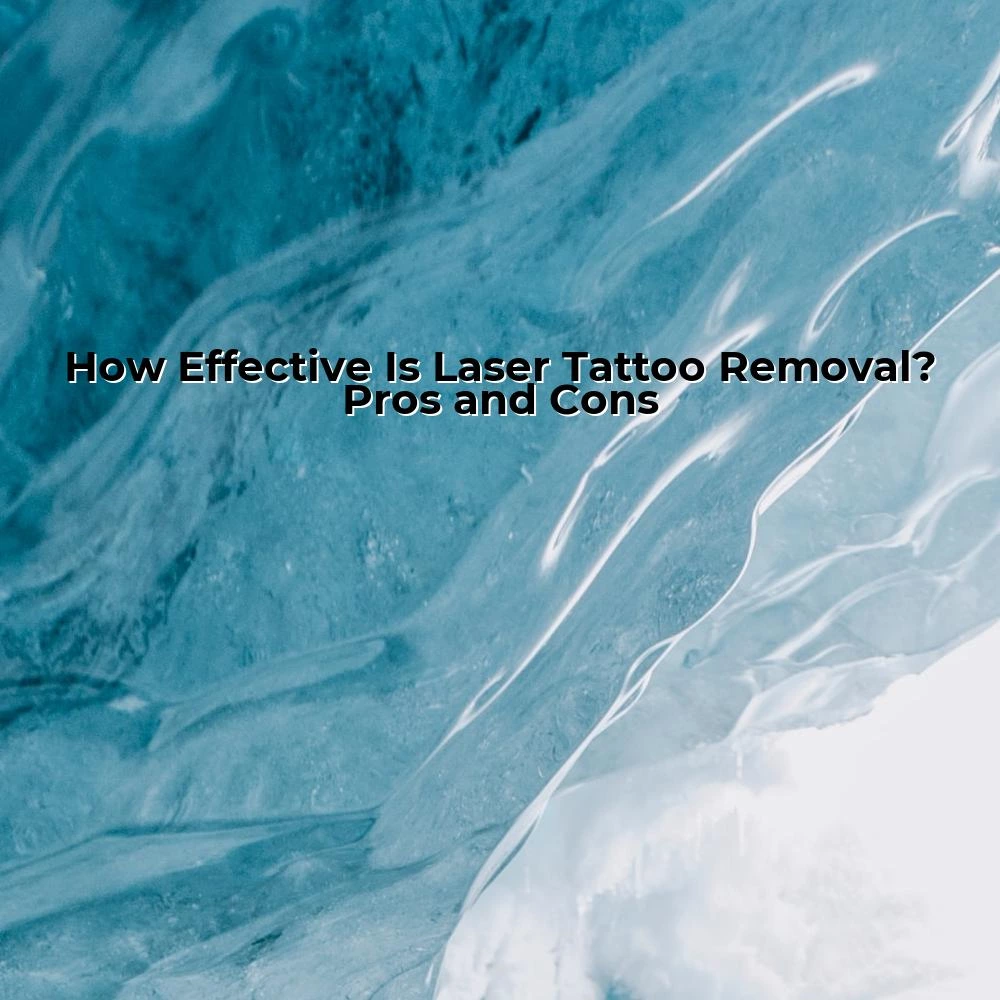 How Effective Is Laser Tattoo Removal? Pros and Cons