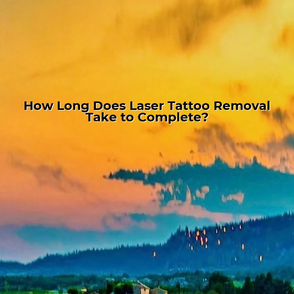 How Long Does Laser Tattoo Removal Take to Complete?