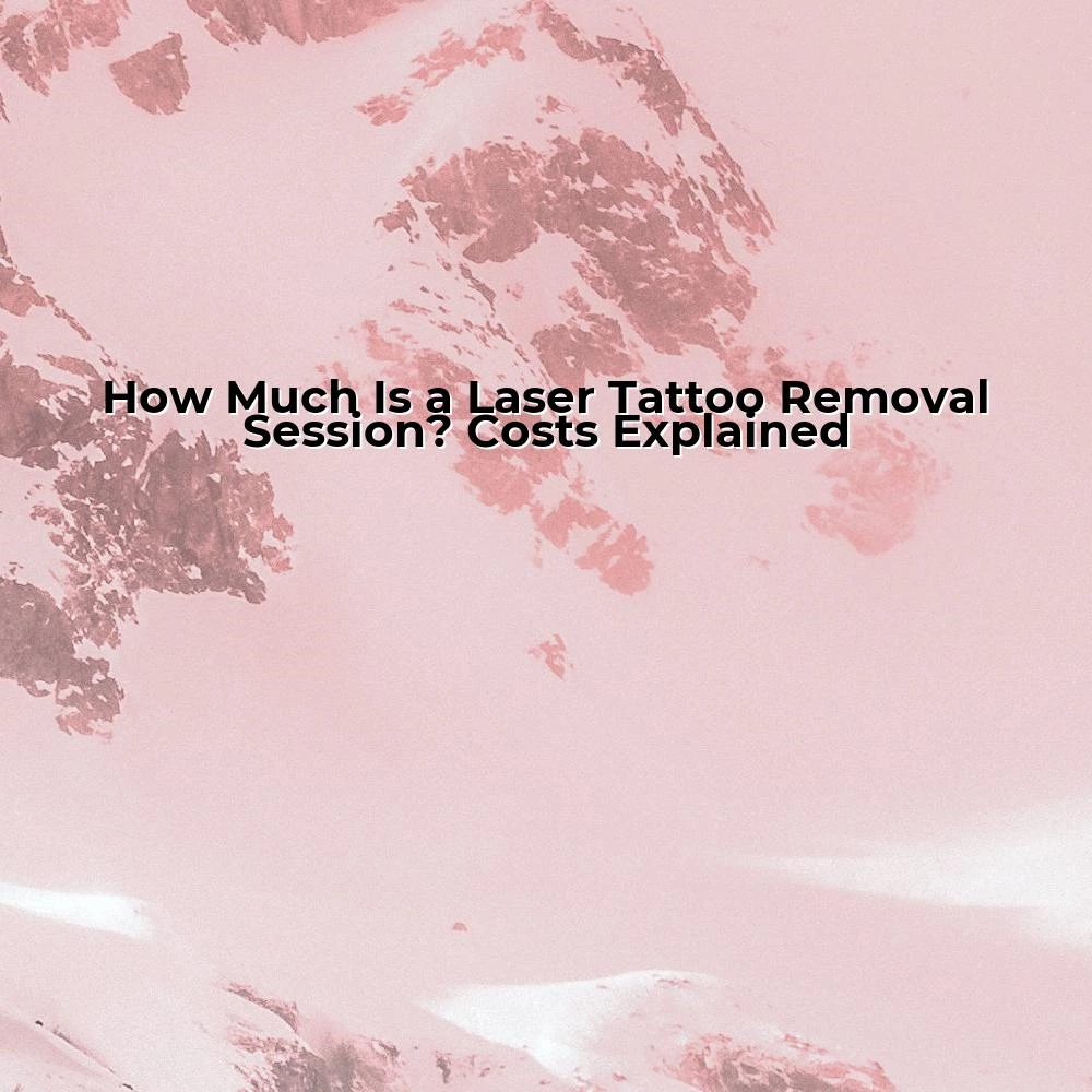 How Much Is a Laser Tattoo Removal Session? Costs Explained