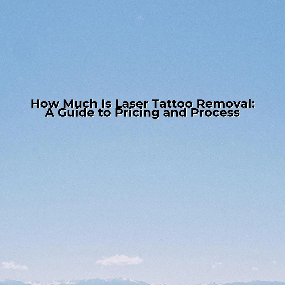 How Much Is Laser Tattoo Removal