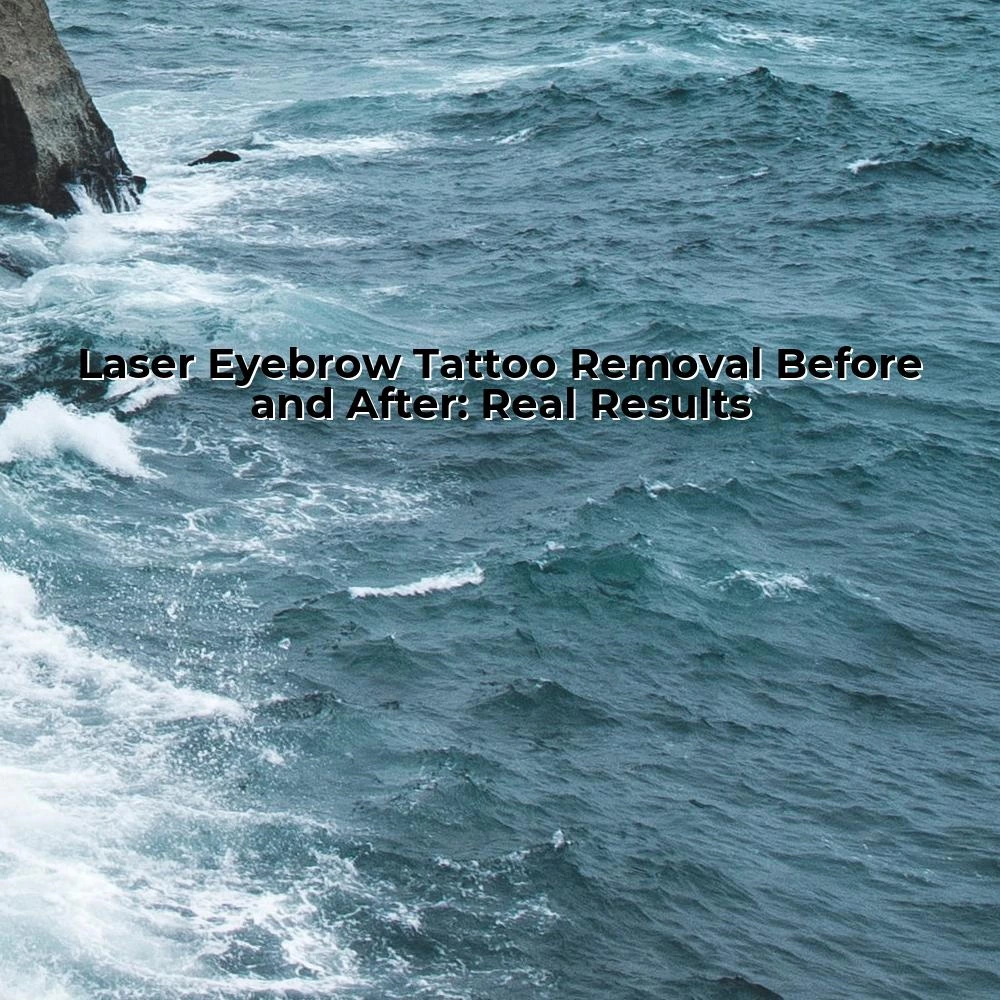 Laser Eyebrow Tattoo Removal Before and After