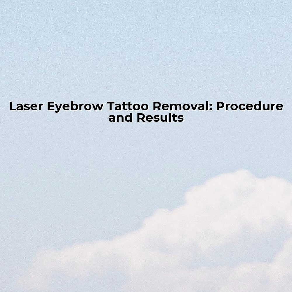 Laser Eyebrow Tattoo Removal