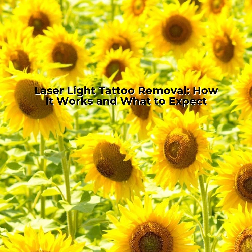 Laser Light Tattoo Removal