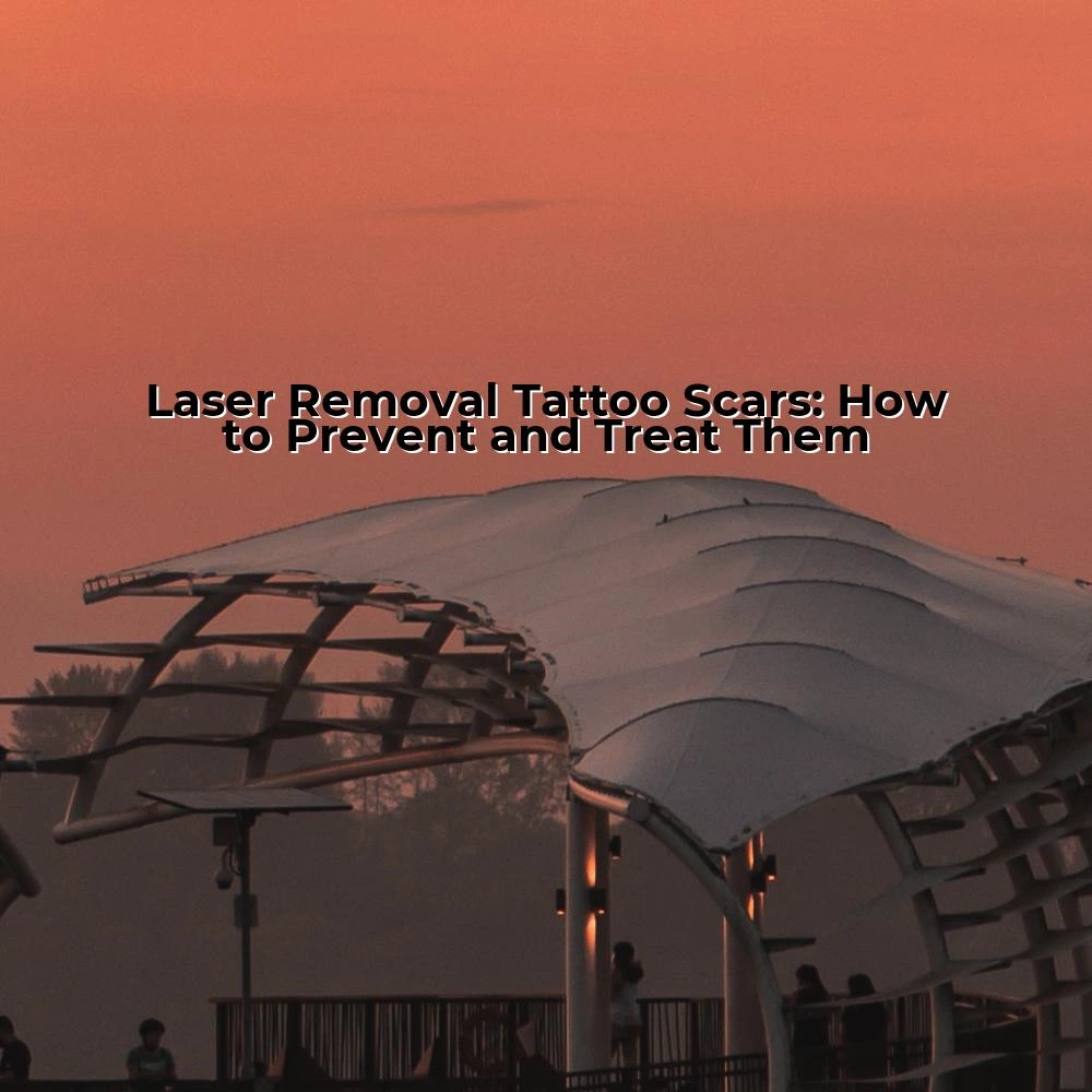 Laser Removal Tattoo Scars