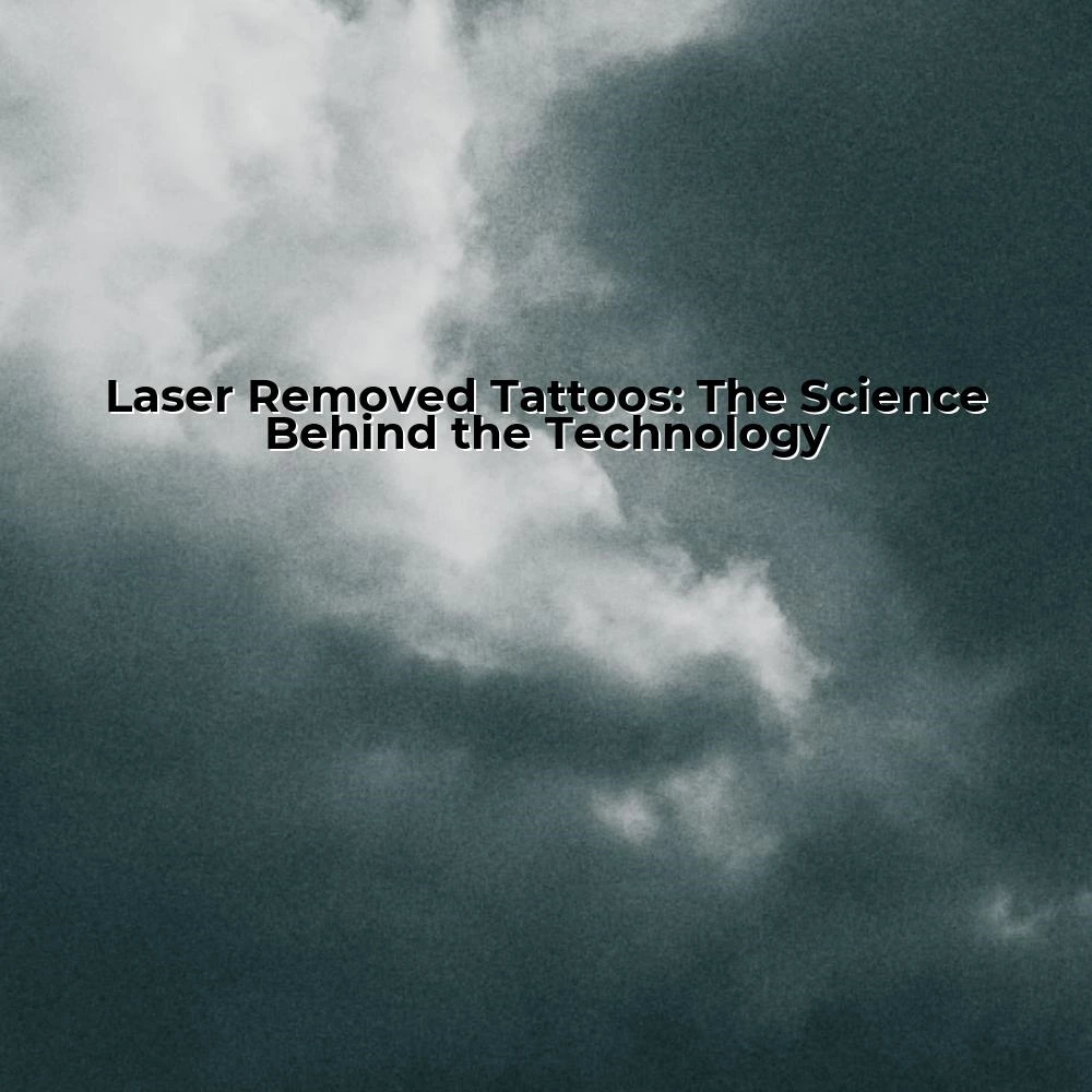 Laser Removed Tattoos