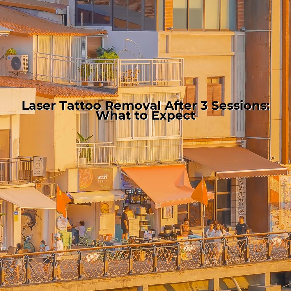 Laser Tattoo Removal After 3 Sessions