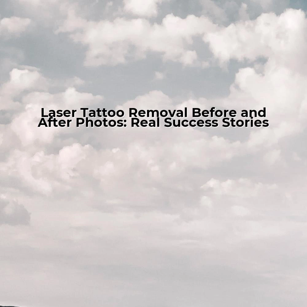 Laser Tattoo Removal Before and After Photos