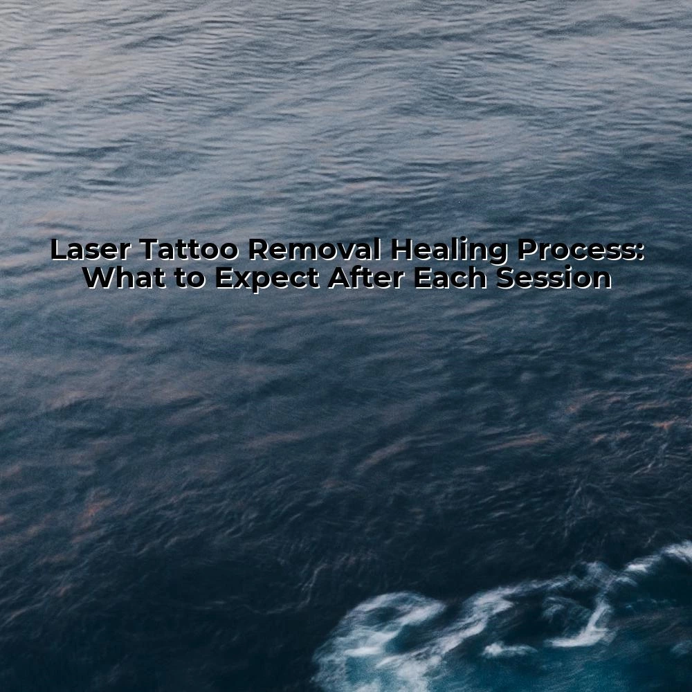 Laser Tattoo Removal Healing Process