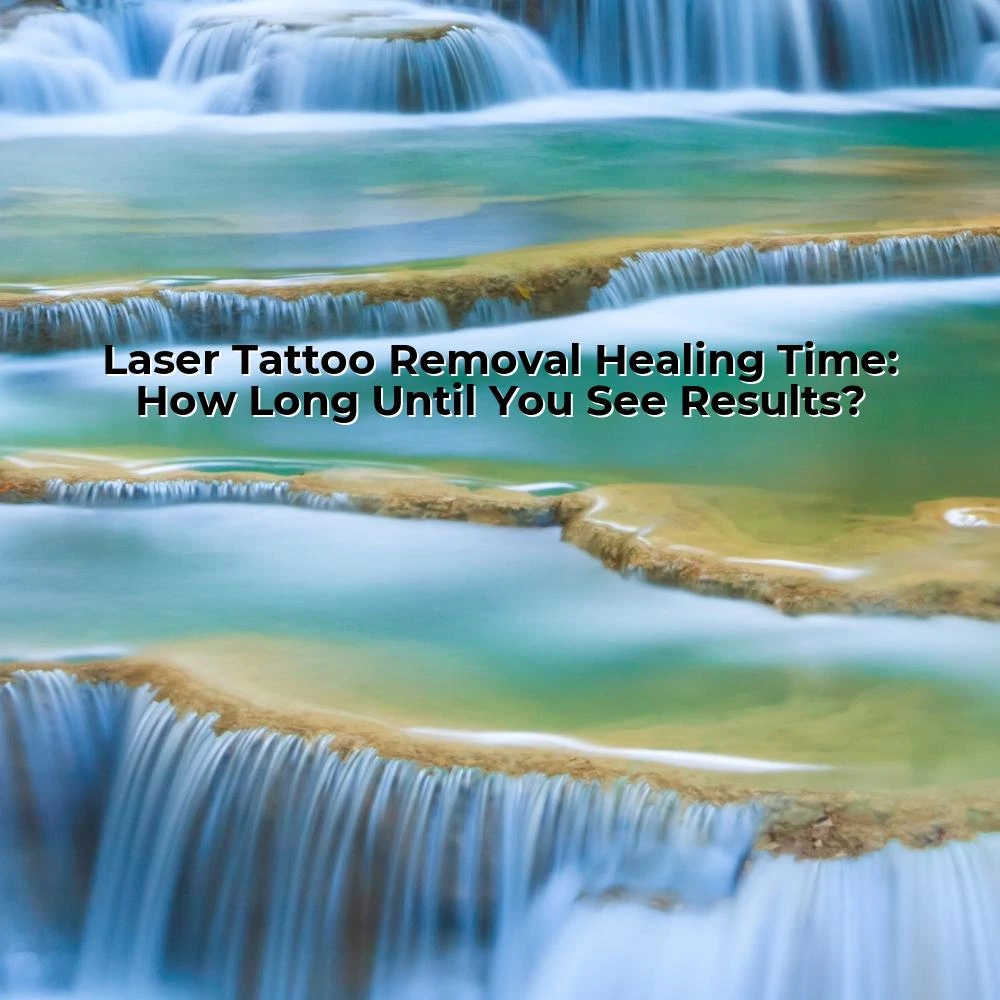 Laser Tattoo Removal Healing Time