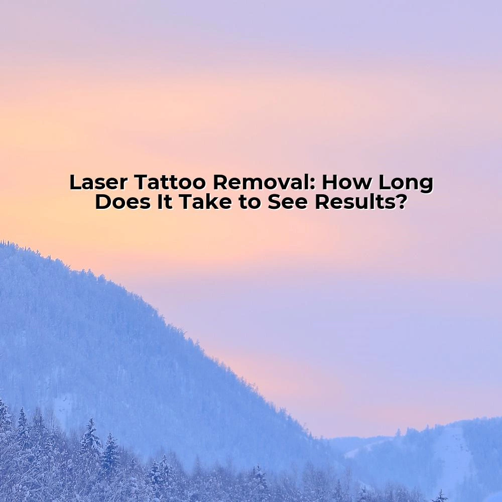 Laser Tattoo Removal