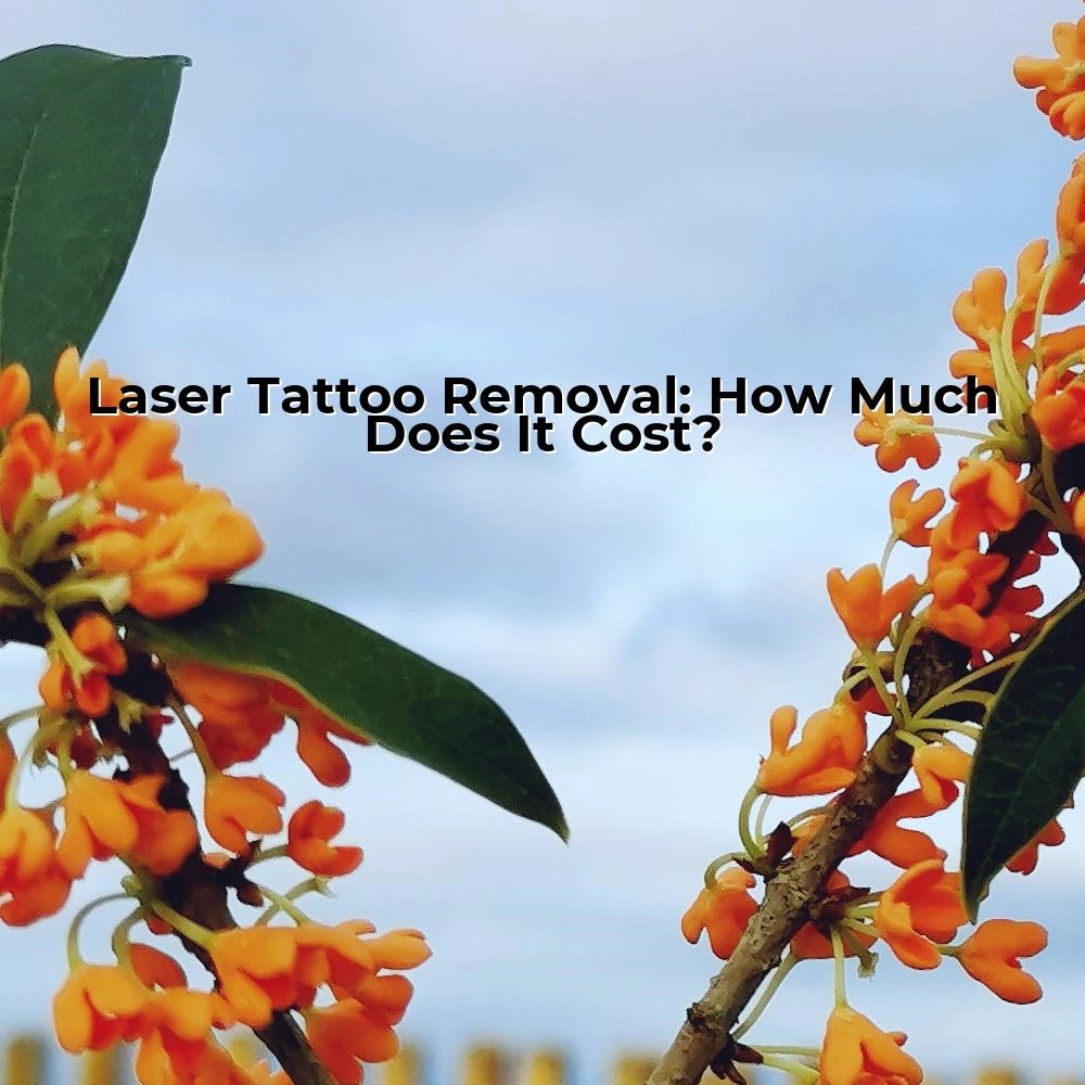 Laser Tattoo Removal