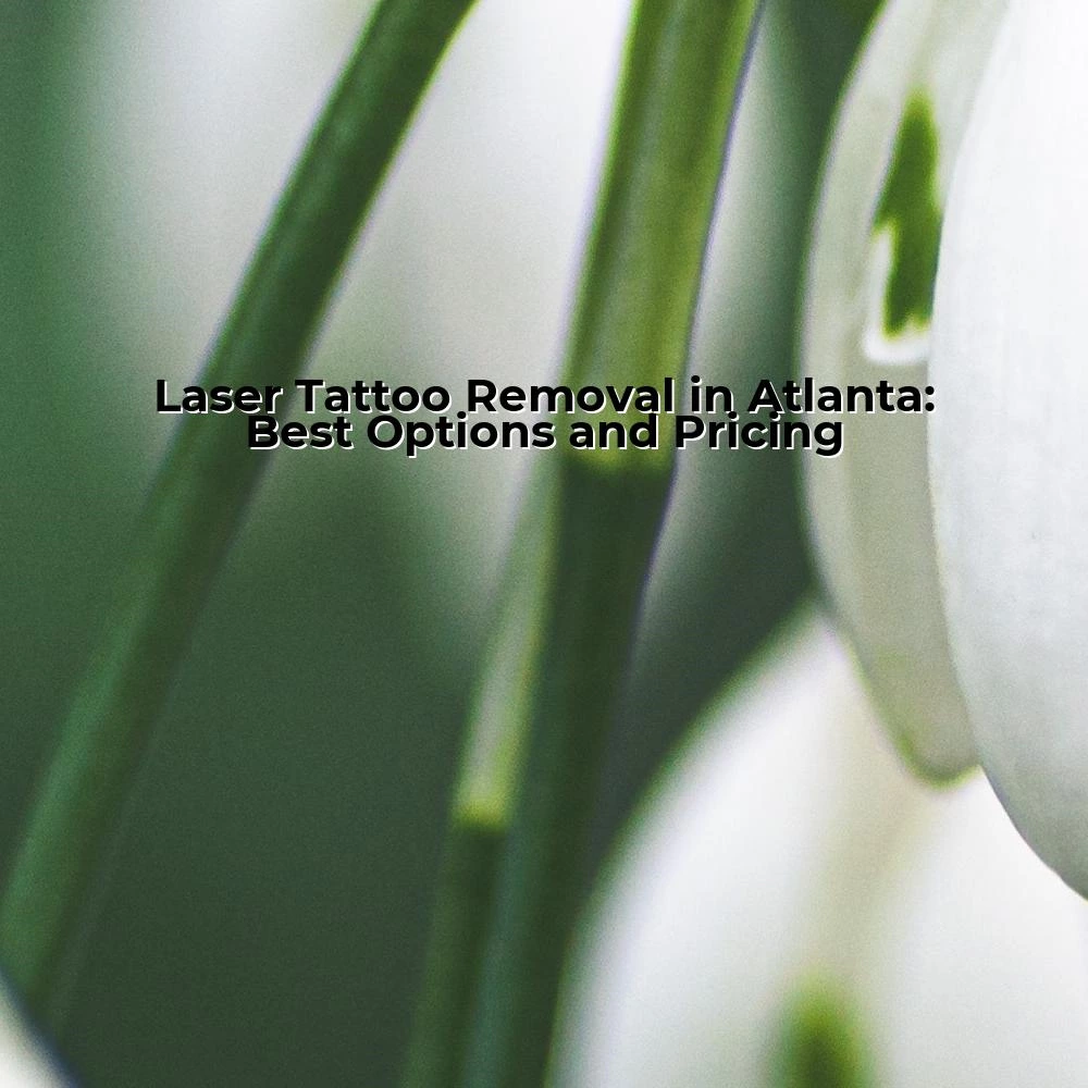 Laser Tattoo Removal in Atlanta