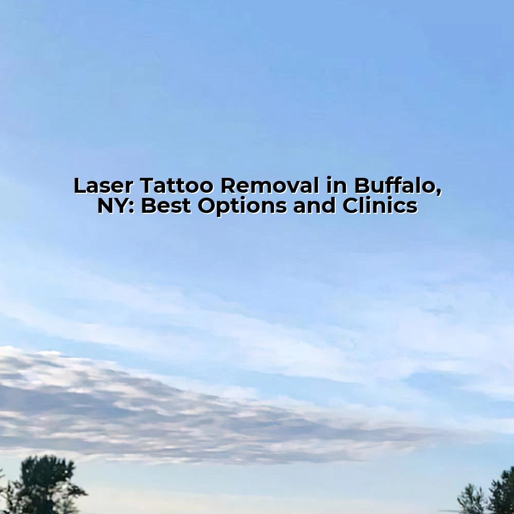 Laser Tattoo Removal in Buffalo, NY