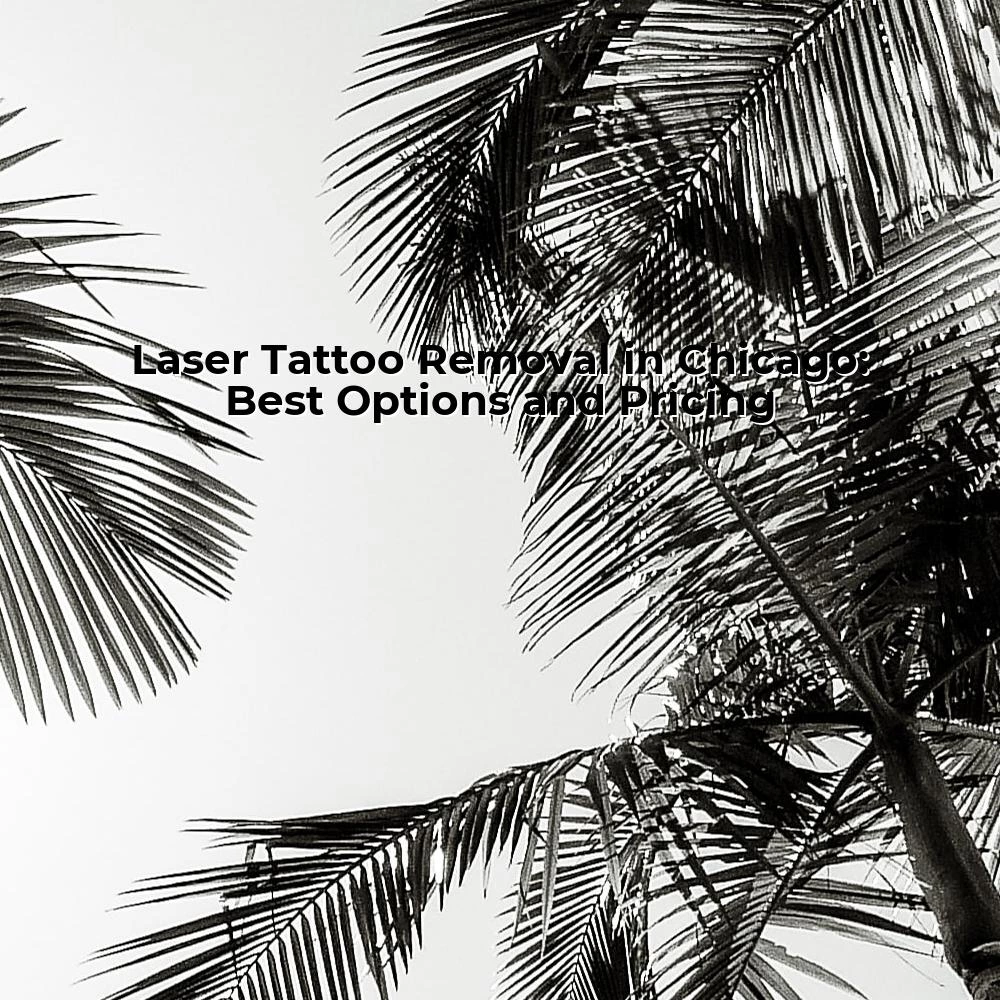 Laser Tattoo Removal in Chicago