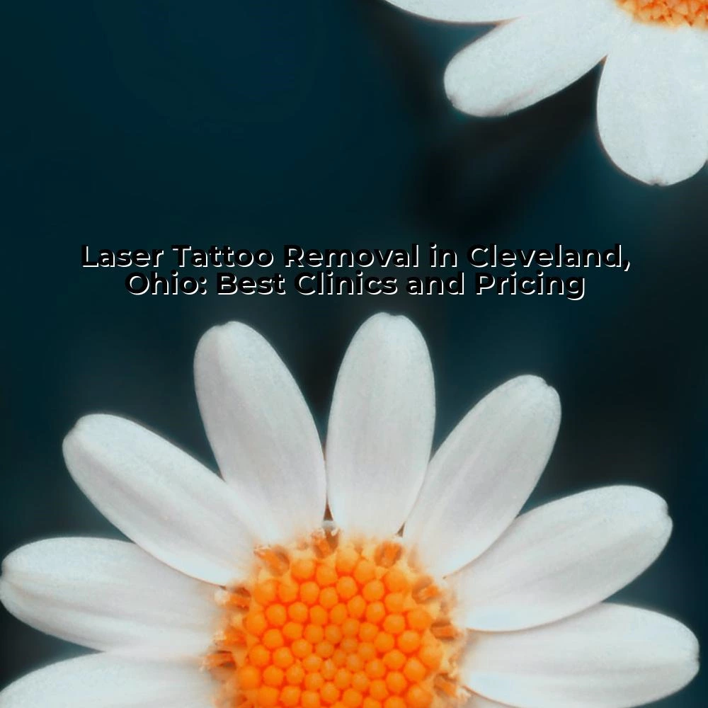 Laser Tattoo Removal in Cleveland, Ohio