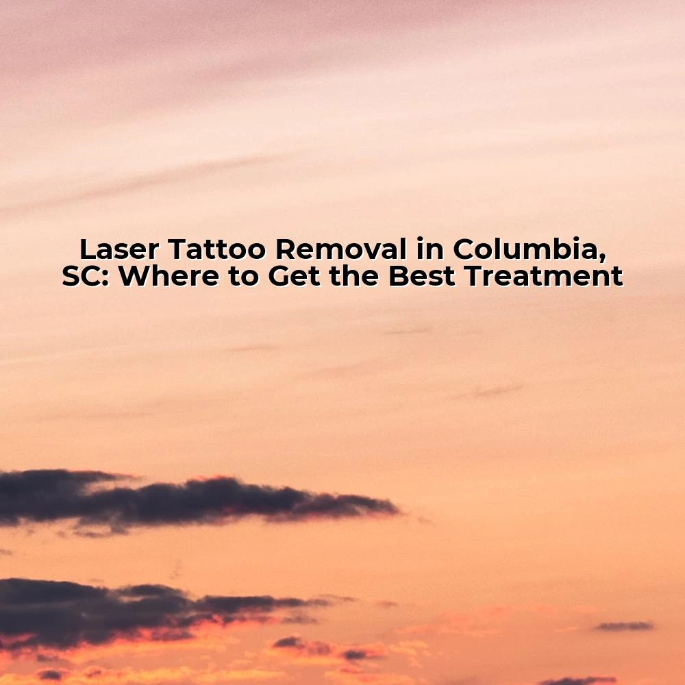 Laser Tattoo Removal in Columbia, SC