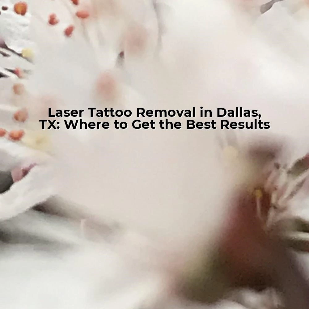 Laser Tattoo Removal in Dallas, TX