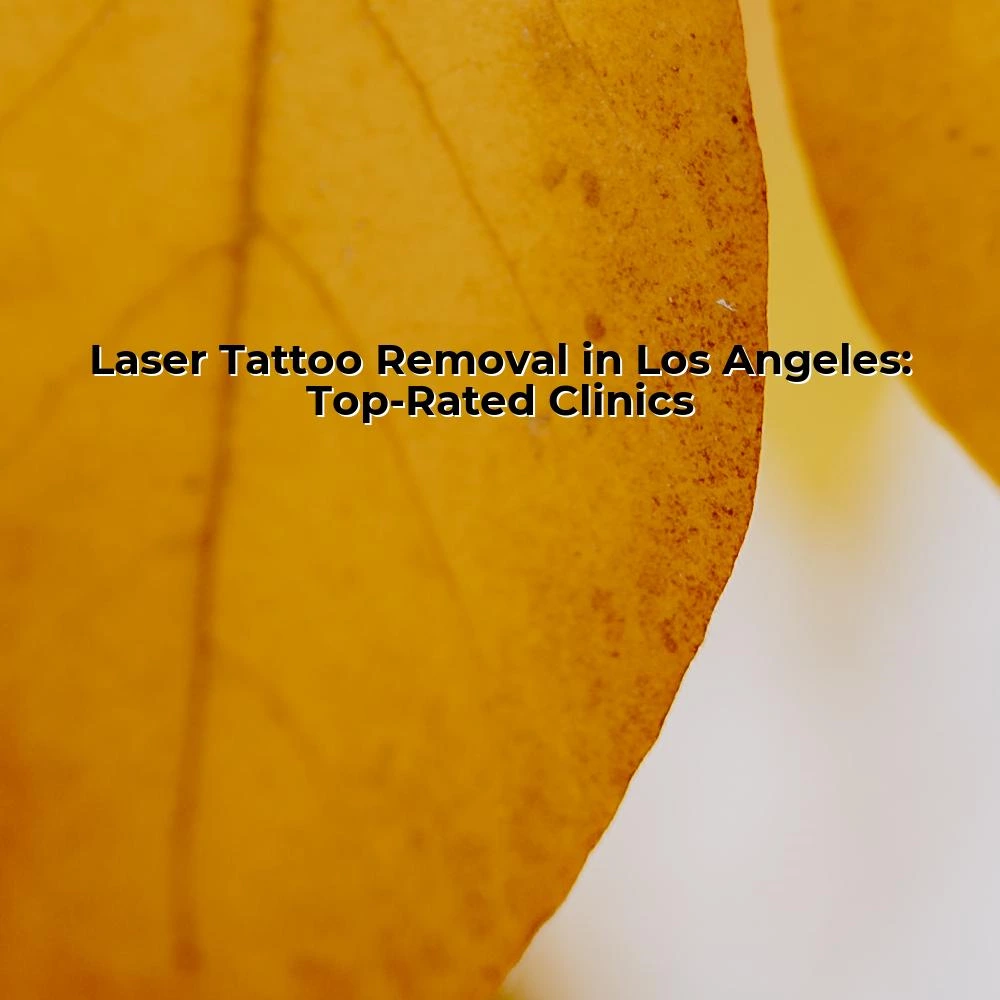 Laser Tattoo Removal in Los Angeles