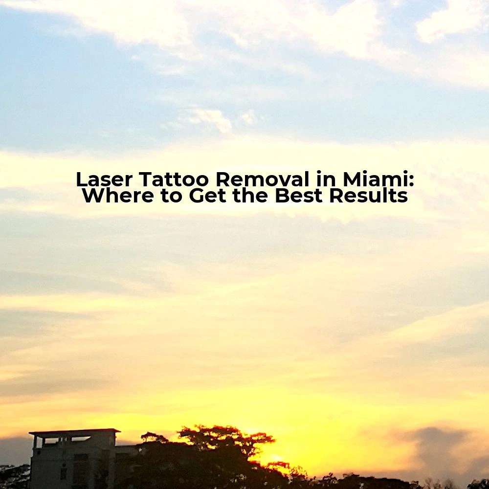 Laser Tattoo Removal in Miami