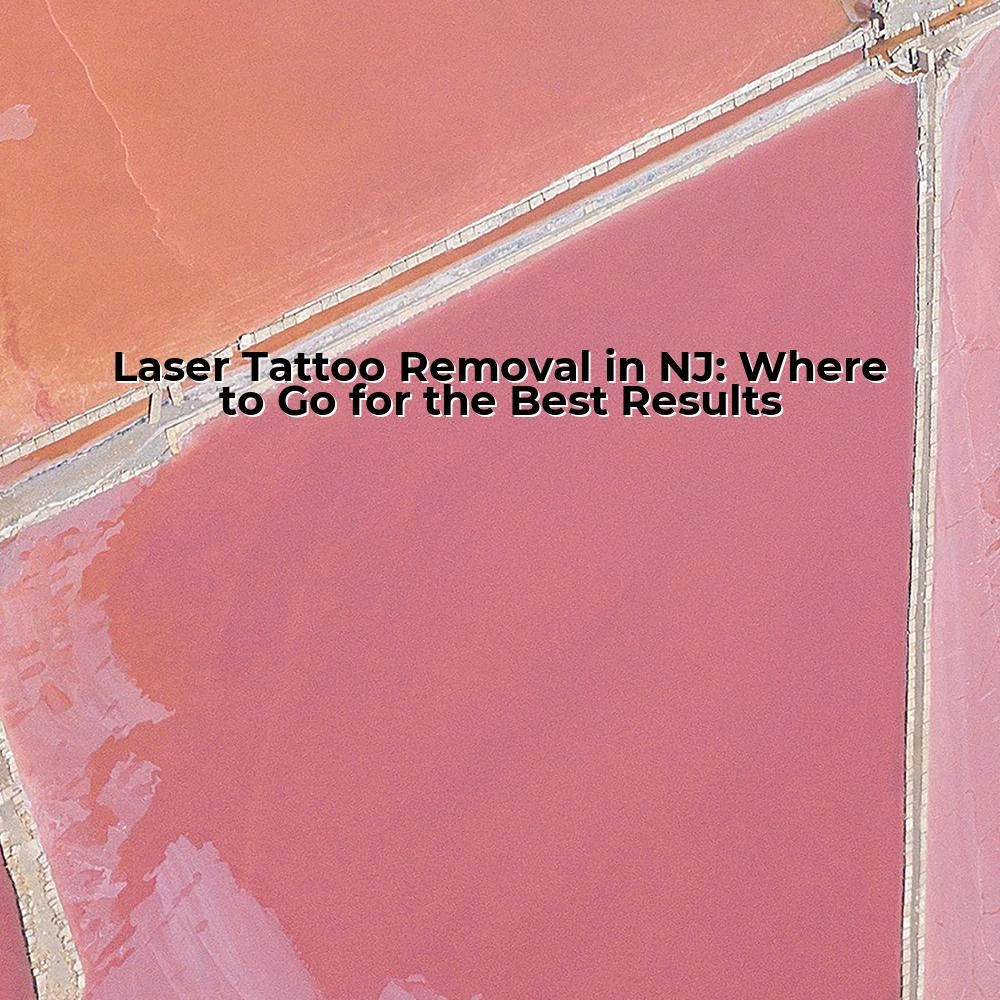 Laser Tattoo Removal in NJ