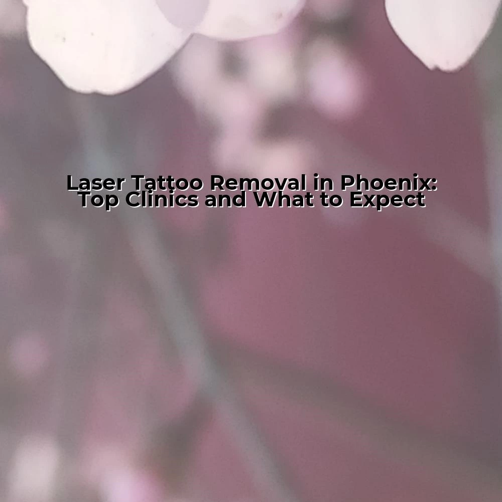 Laser Tattoo Removal in Phoenix