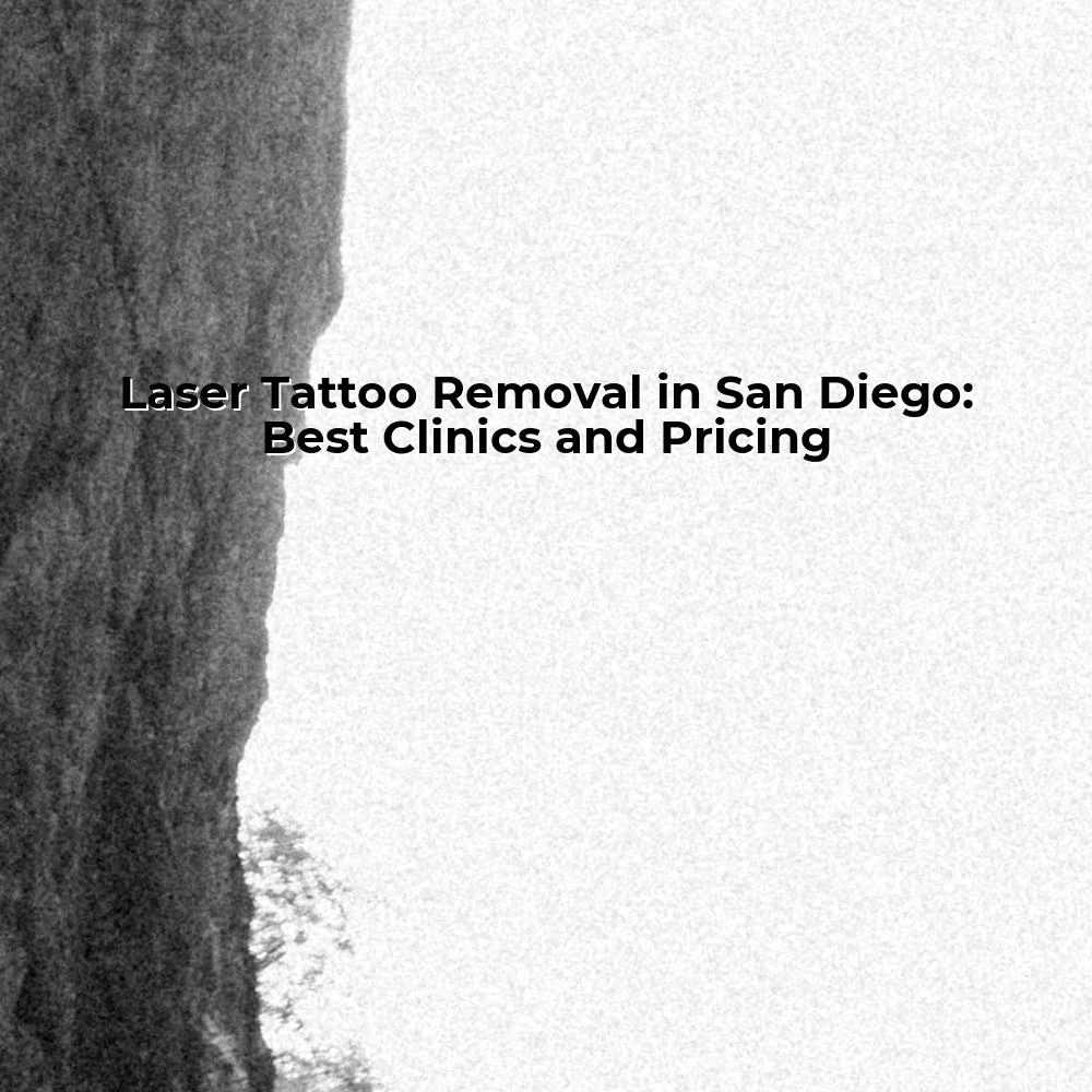 Laser Tattoo Removal in San Diego