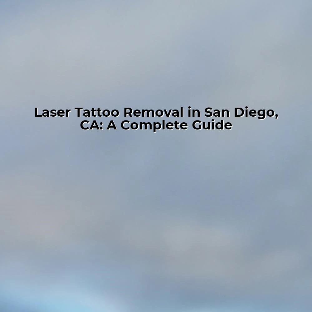 Laser Tattoo Removal in San Diego, CA