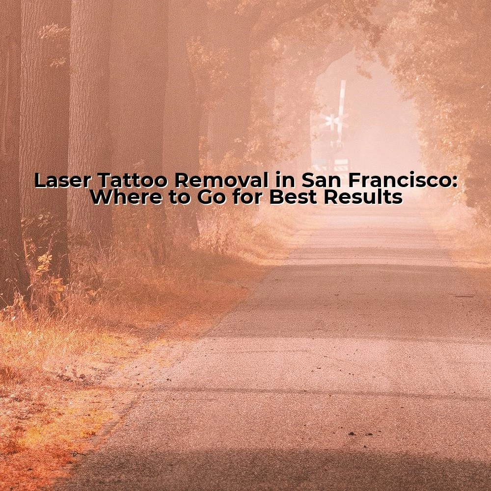 Laser Tattoo Removal in San Francisco