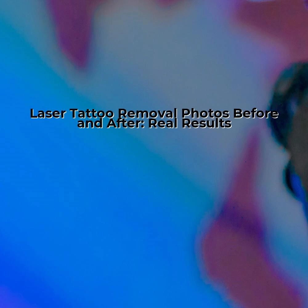 Laser Tattoo Removal Photos Before and After