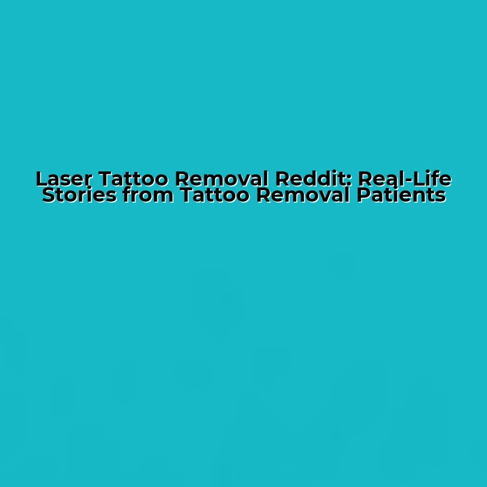 Laser Tattoo Removal Reddit