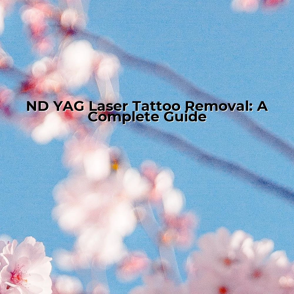 ND YAG Laser Tattoo Removal