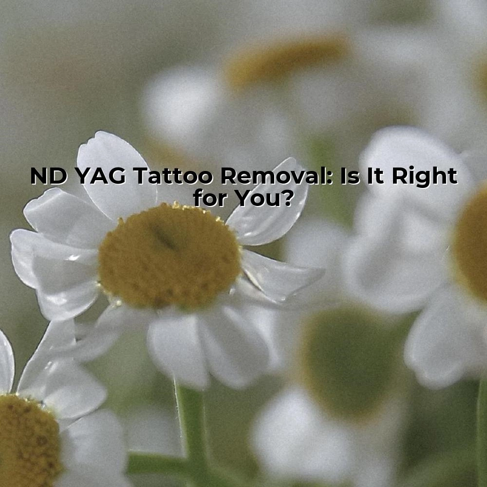 ND YAG Tattoo Removal