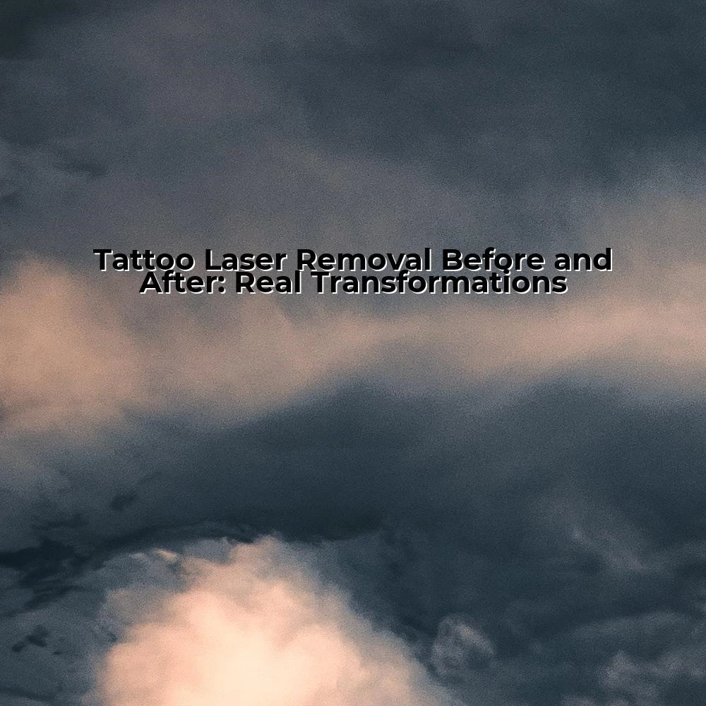 Tattoo Laser Removal Before and After