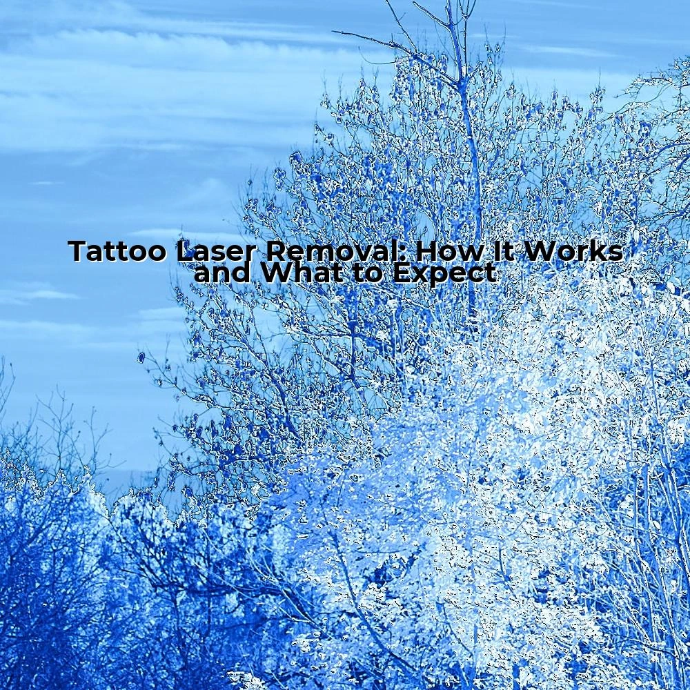 Tattoo Laser Removal