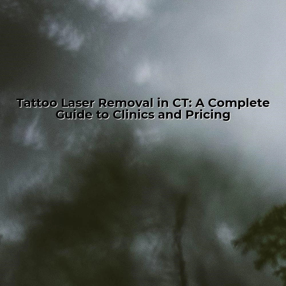 Tattoo Laser Removal in CT