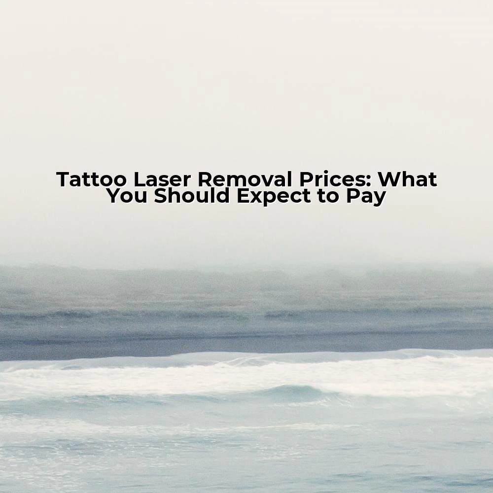 Tattoo Laser Removal Prices