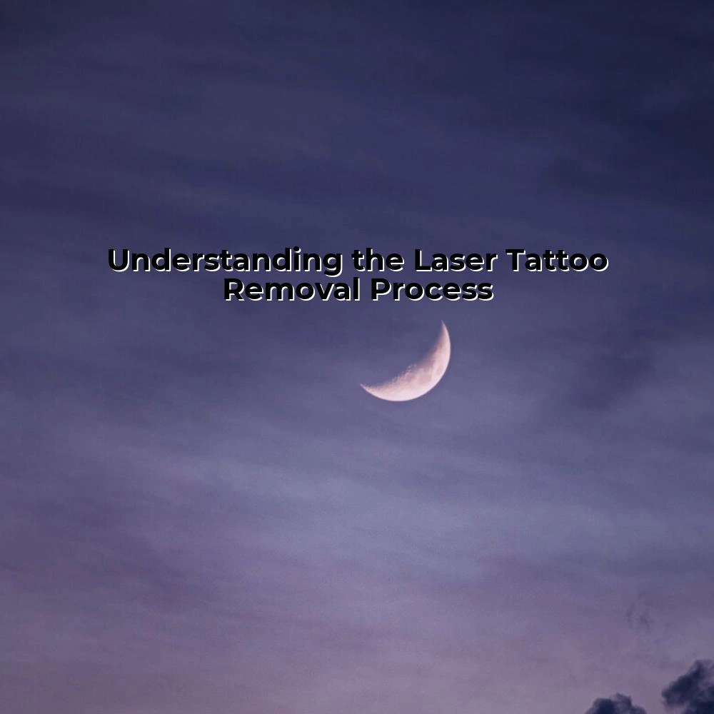 Understanding the Laser Tattoo Removal Process