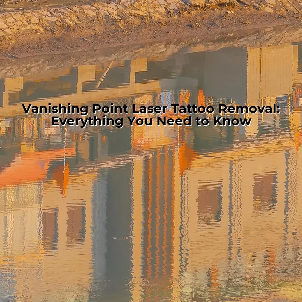 Vanishing Point Laser Tattoo Removal