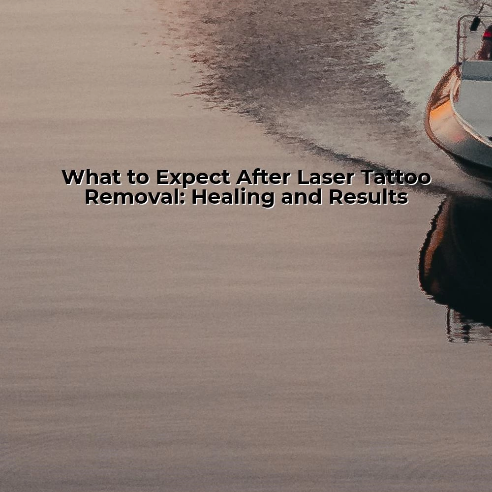 What to Expect After Laser Tattoo Removal